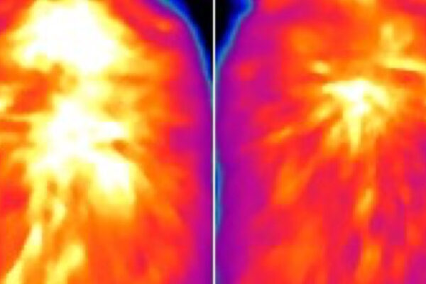 Novel way to ‘rev up’ brown fat burns calories, limits obesity in mice