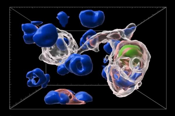 Body’s garbage-collecting cells protect insulin production in pancreas