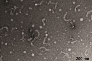 imagines of matrin 3 protein