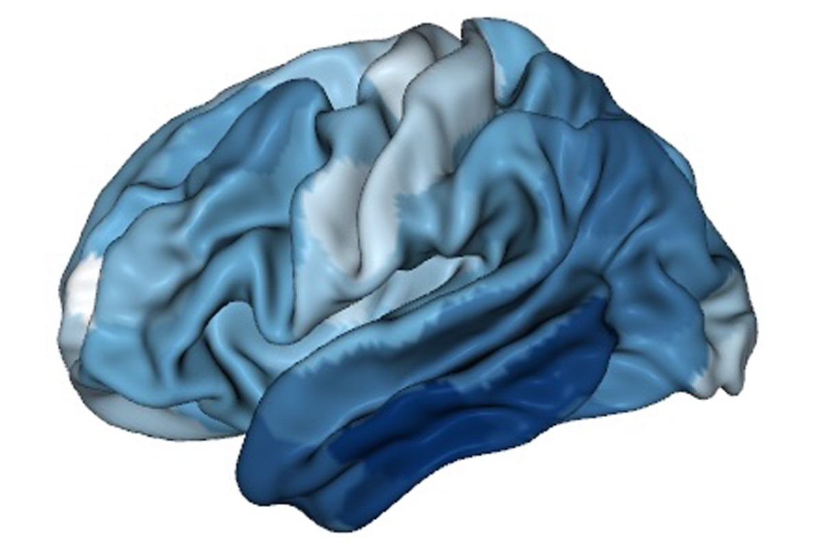 $5 million for brain development and Alzheimer’s degeneration study