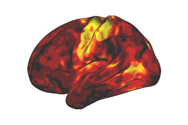 Stimulant ADHD medications work differently than thought