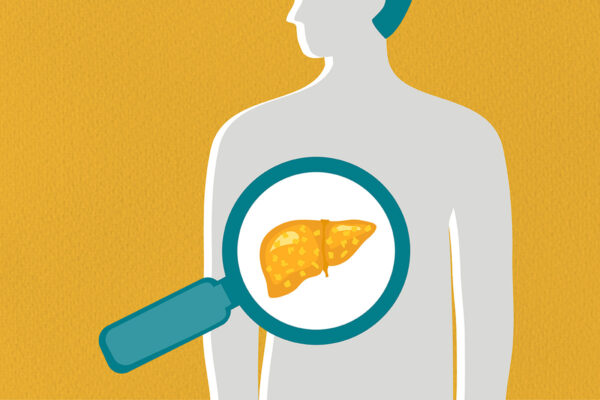 A risk factor for liver disease: your parent’s body weight