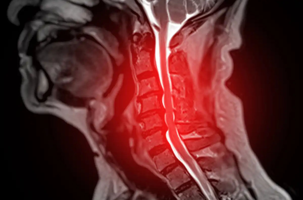 Clinically informed AI outperforms foundation models in spinal cord disease prediction – The Source