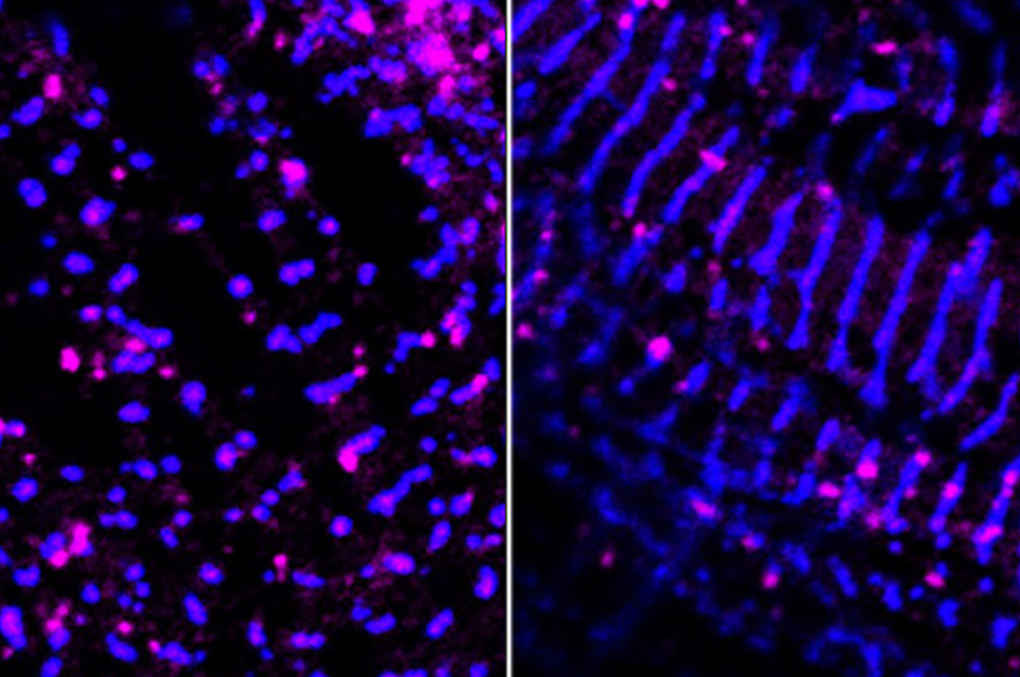 Probing a paradoxical drug response for irregular heartbeat