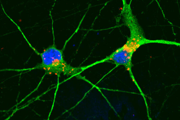 Chemical compound clears cellular waste, protects neurons in model of frontotemporal dementia
