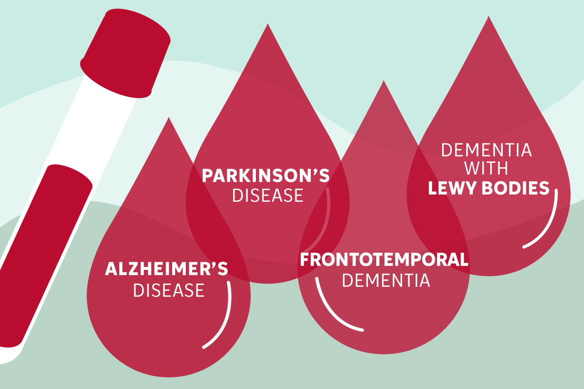 glutathione parkinson's perlmutter Joel Perlmutter, MD | Neurology