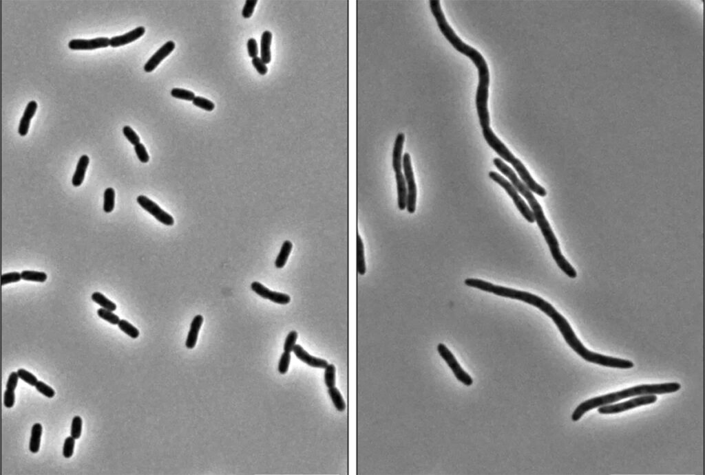 image of virulent bacteria