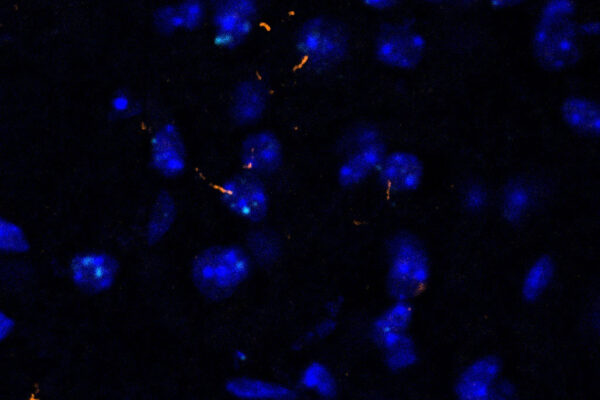 Skeletal muscle signals to brain, brown fat to control aging in mice 