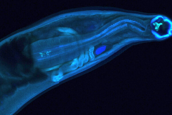 Genetically modified hookworms produce and deliver therapeutics