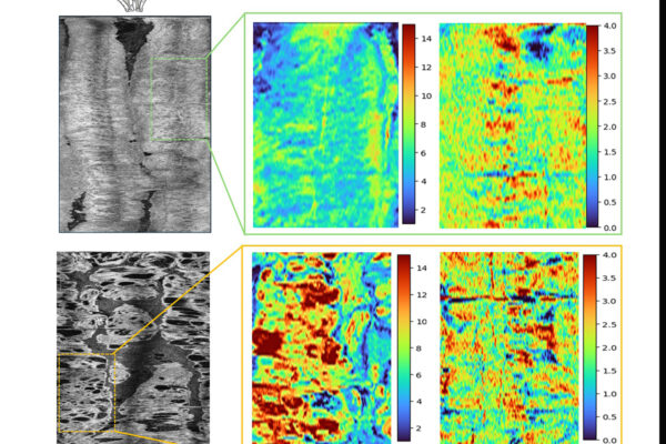 Quick optical biopsy could be early detection method for endometrial cancer
