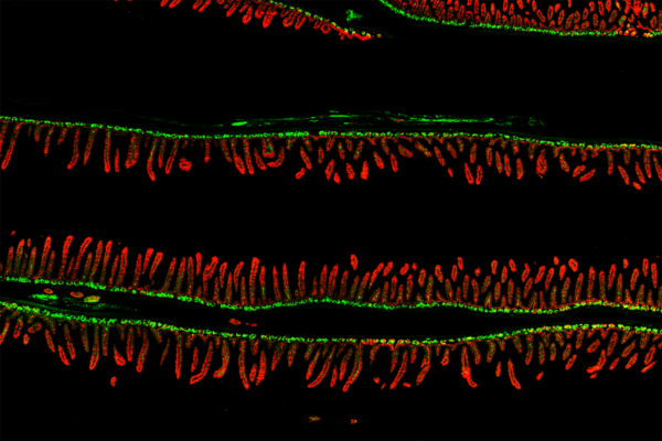 Gut bacteria linked to malnutrition may pass to younger generations