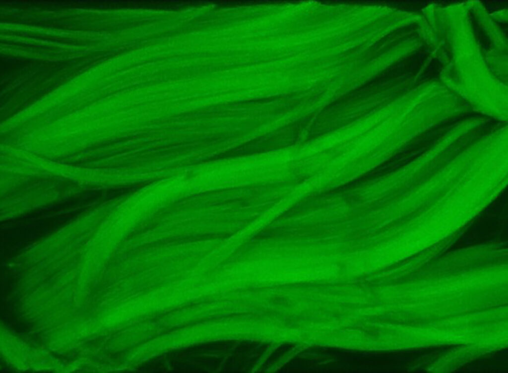 green tendon fiber