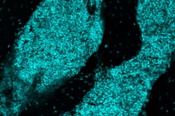 Newly found ‘immune organ’ inside skull directs brain defense