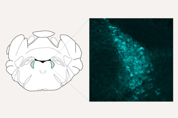 Scientists identify brain’s brake that shuts off chronic&nbsp;pain