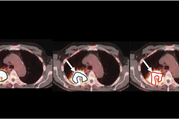 Technique evaluates reliability of imaging measurements used in medical decision-making