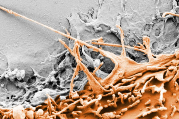 Tiny feet on cells sense defects, stall migration to heal wounds