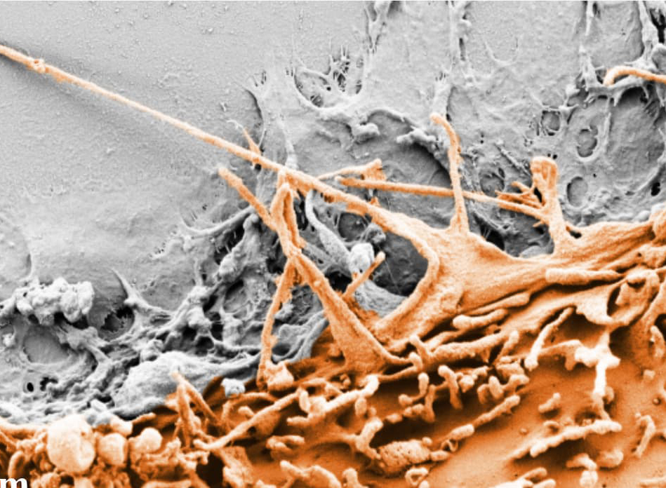 a image of cellular protuberance
