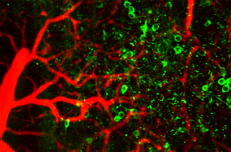 lit up blood vessels and green florescent calcium imaging in neurons