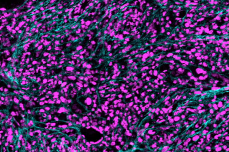 $11.7M from NIH supports research on inflammation in blood cancers