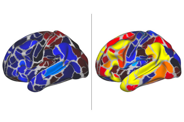 Brain activity varies with age in children with autistic traits 