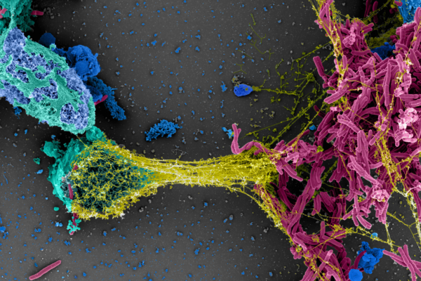 New Transcend Initiative to address mycobacteria threats