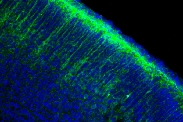 Build-up of common enzyme stunts brain growth