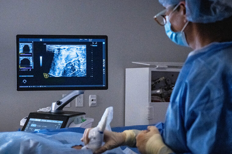 Freezing out tumors with cryoablation