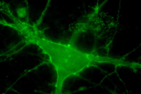 Brain cells regulate cholesterol to control neuron signaling